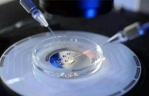 试管婴儿全程需多少天？
