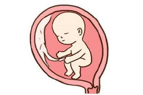 卵巢位置不正常，去美国做试管婴儿影响取卵吗？