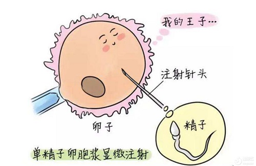 试管婴儿助孕前一定要做输卵管造影吗？