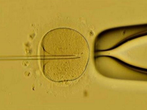 美国试管婴儿专家解读：导致IVF失败的原因是什么？
