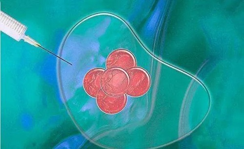 试管婴儿具体的治疗步骤是什么