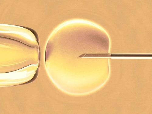 什么是试管婴儿冷冻胚胎？