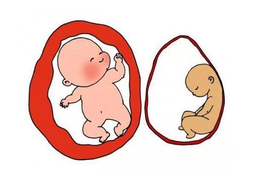 试管婴儿利弊关键的几点